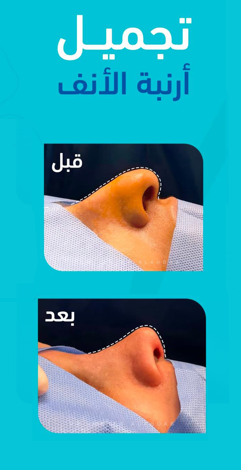 تتتتتت