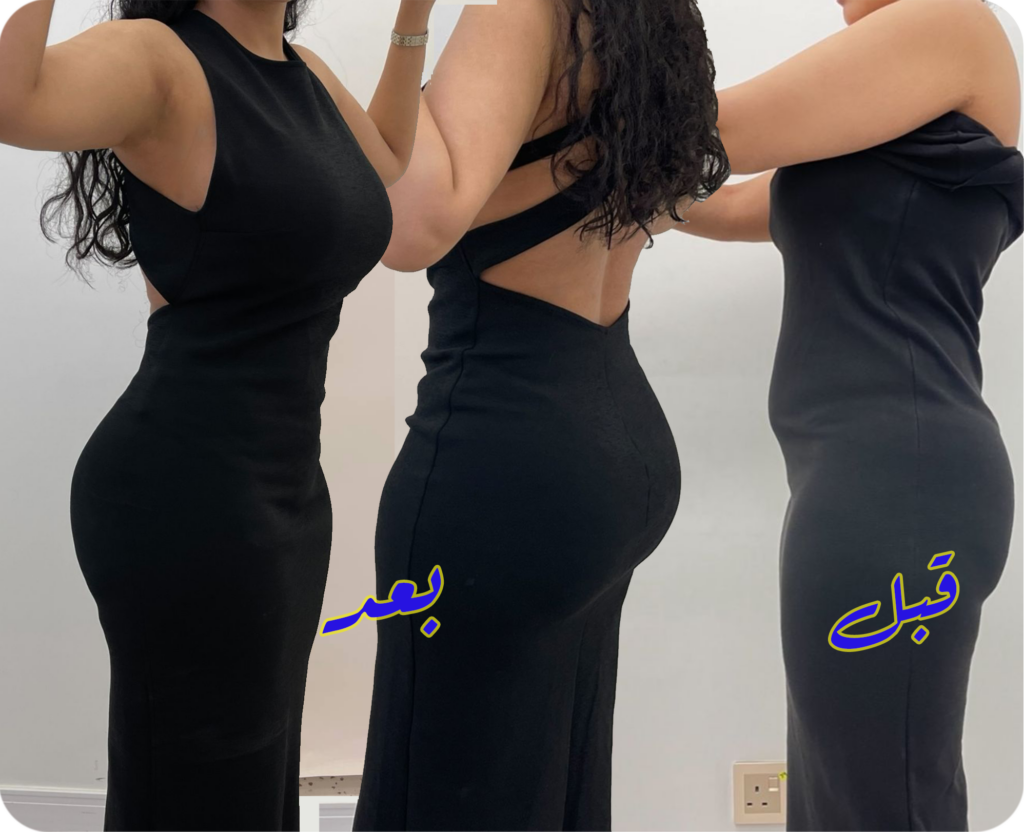 مركز ريجوفيرا الطبي - جراحة التجميل
